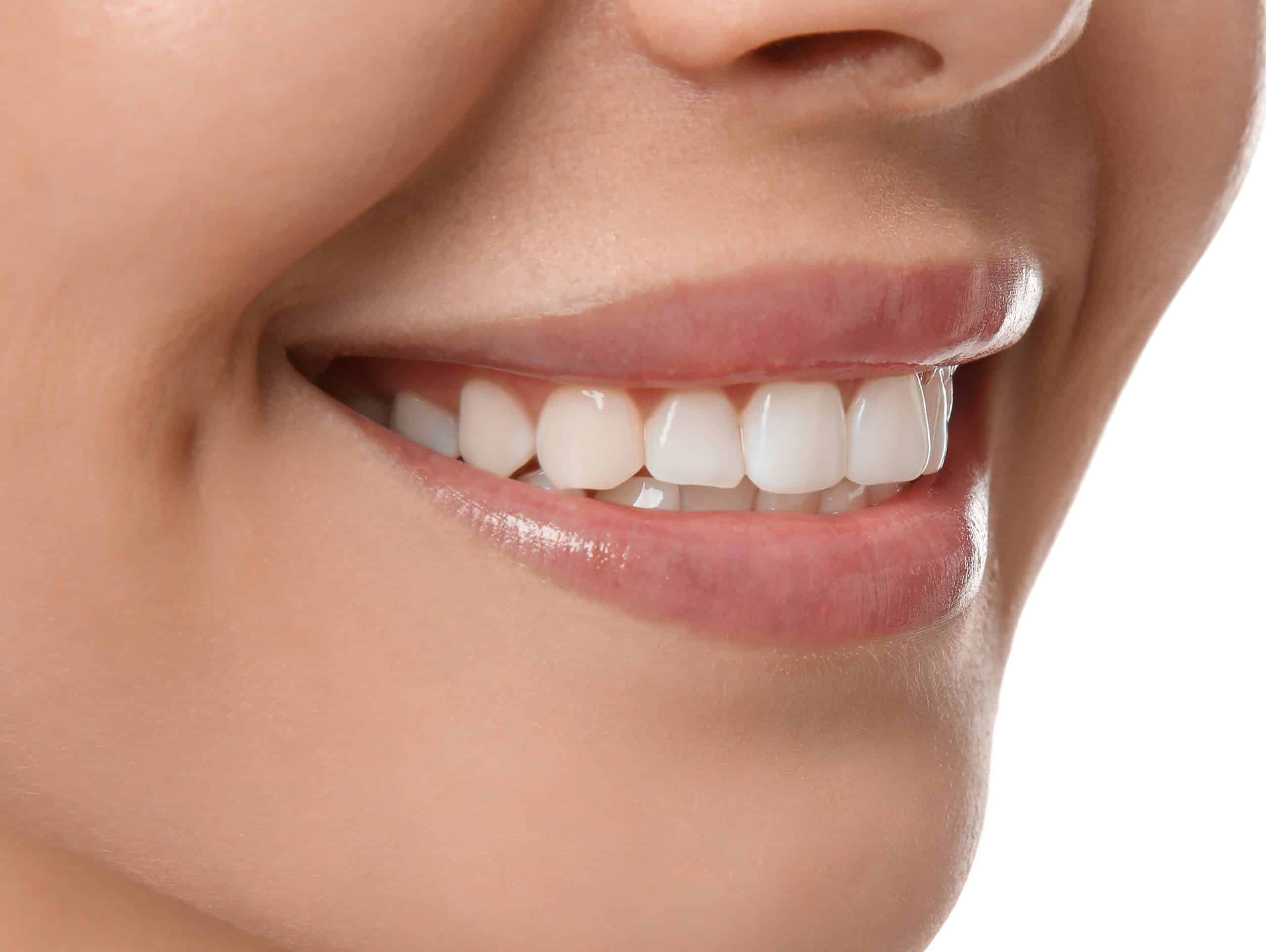 Diş Estetiği Antalya