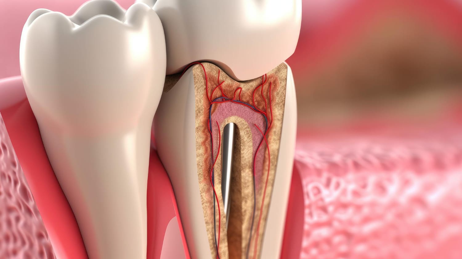 diseases-teeth-inflammation-dental-canals-dentistry-prosthetics-dental-surgery